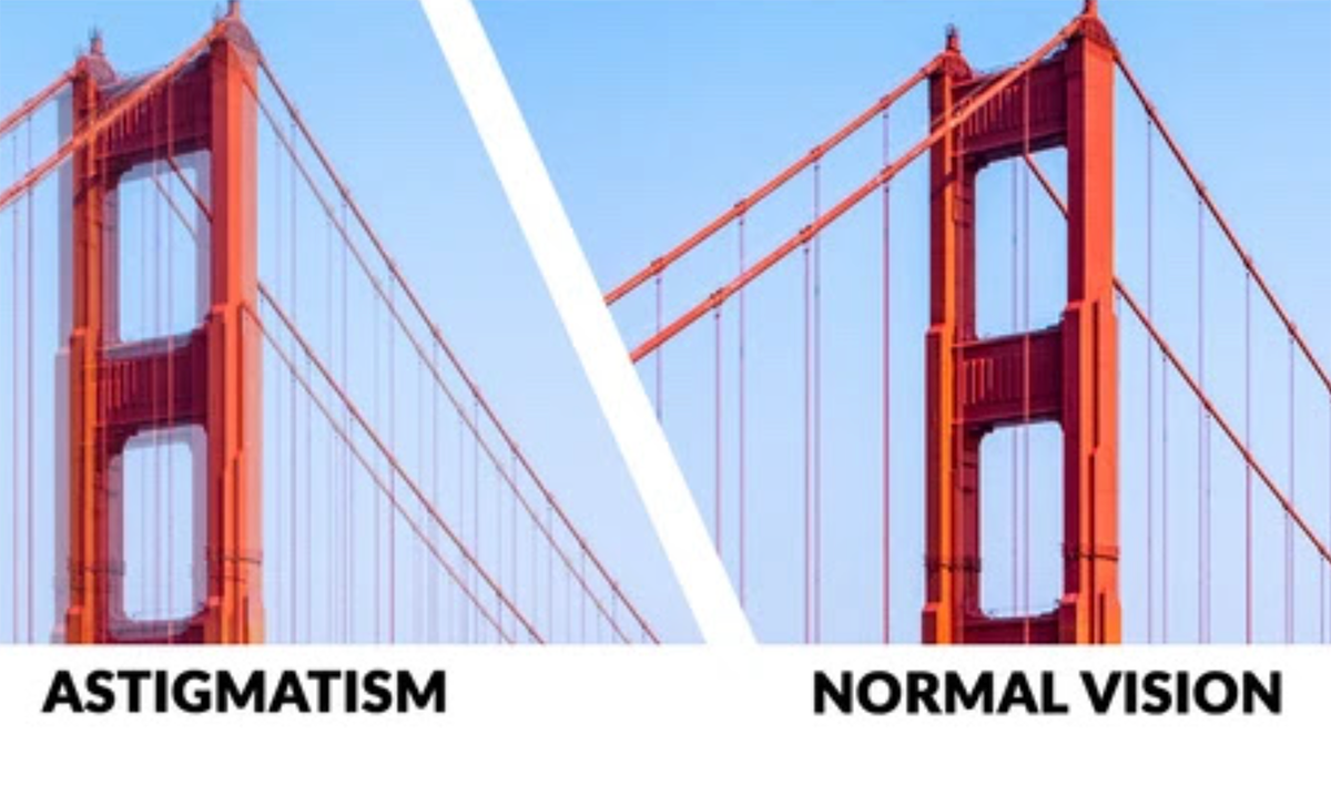 how astigmatism looks compared to normal vision