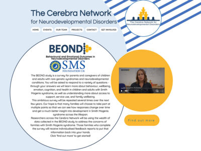 Cerebra Beond project website homepage